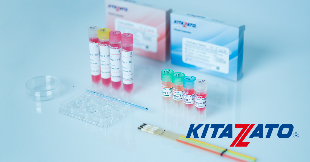 北里コーポレーション(368A)の株価は割安?決算推移・配当・今後5年の株価予想